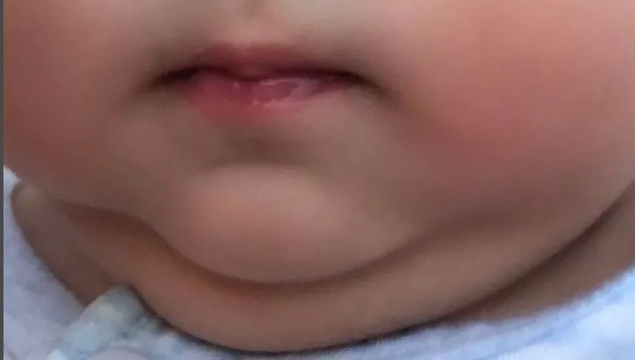 宝宝肉嘟嘟的下巴特写 - 小孩表情包